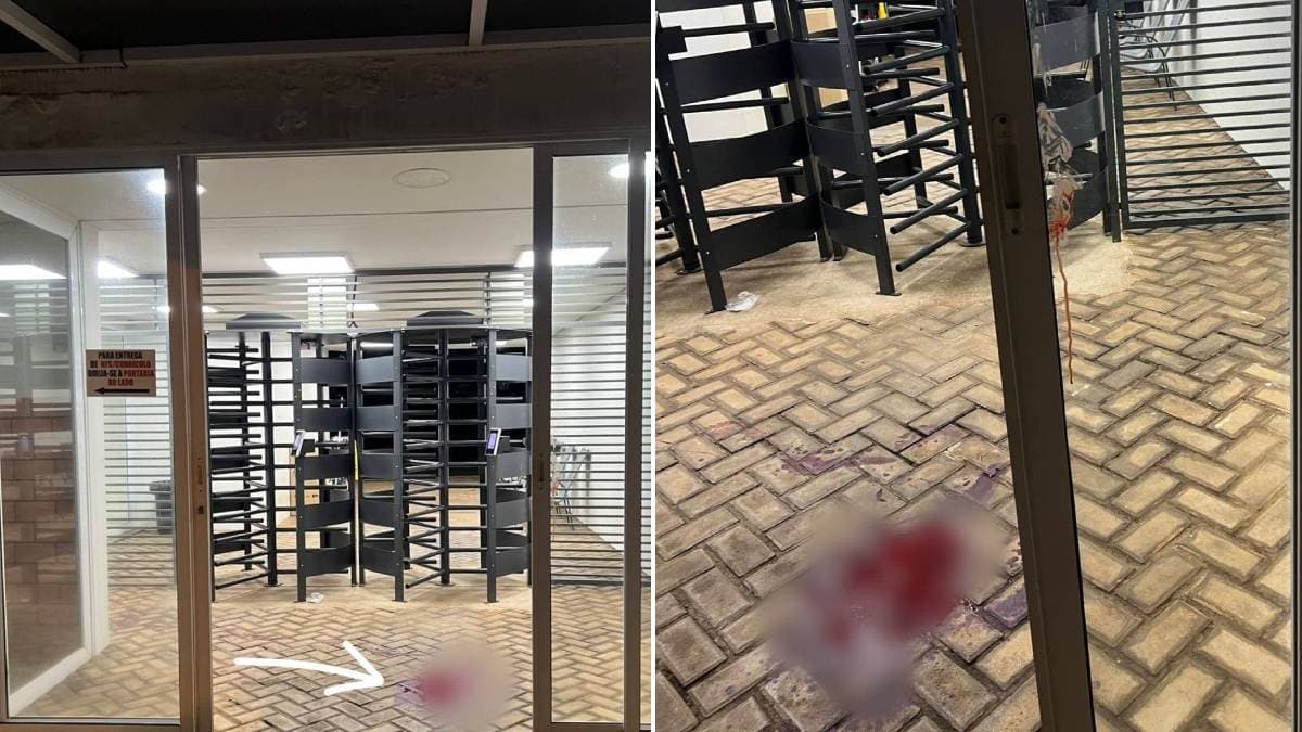 Tentativa de homicídio em Bebedouro: Vítima é operada em estado grave; autor é identificado